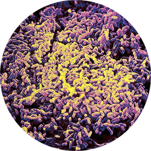 Listeria Monocytogenes